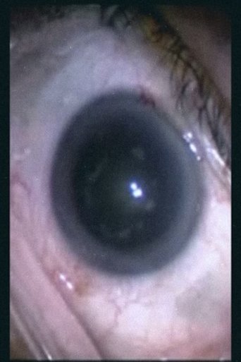 Botched Eyeball Operation Poster of Botched Eyeball Operation