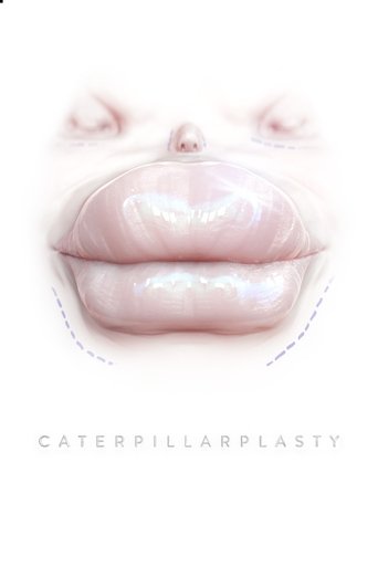 Caterpillarplasty Poster of Caterpillarplasty