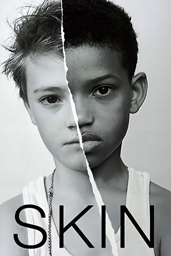 Poster of Skin