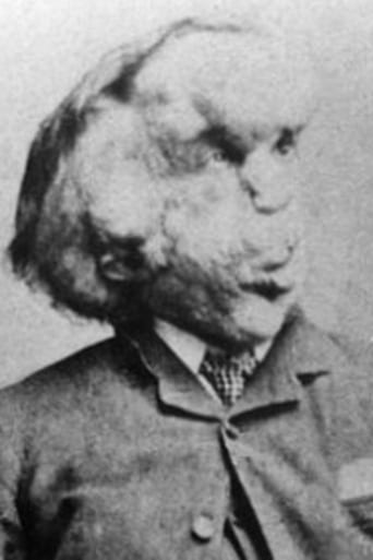 Portrait of Joseph Merrick