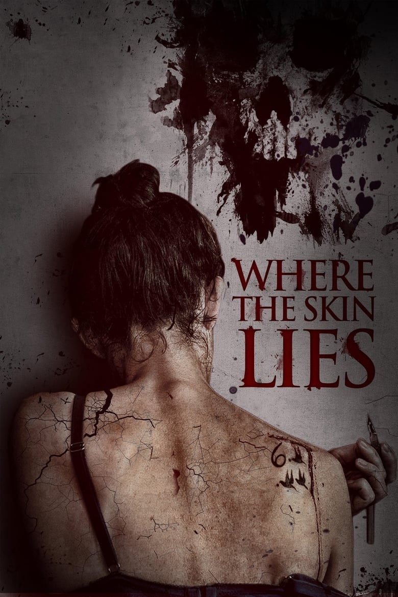 Poster of Where the Skin Lies