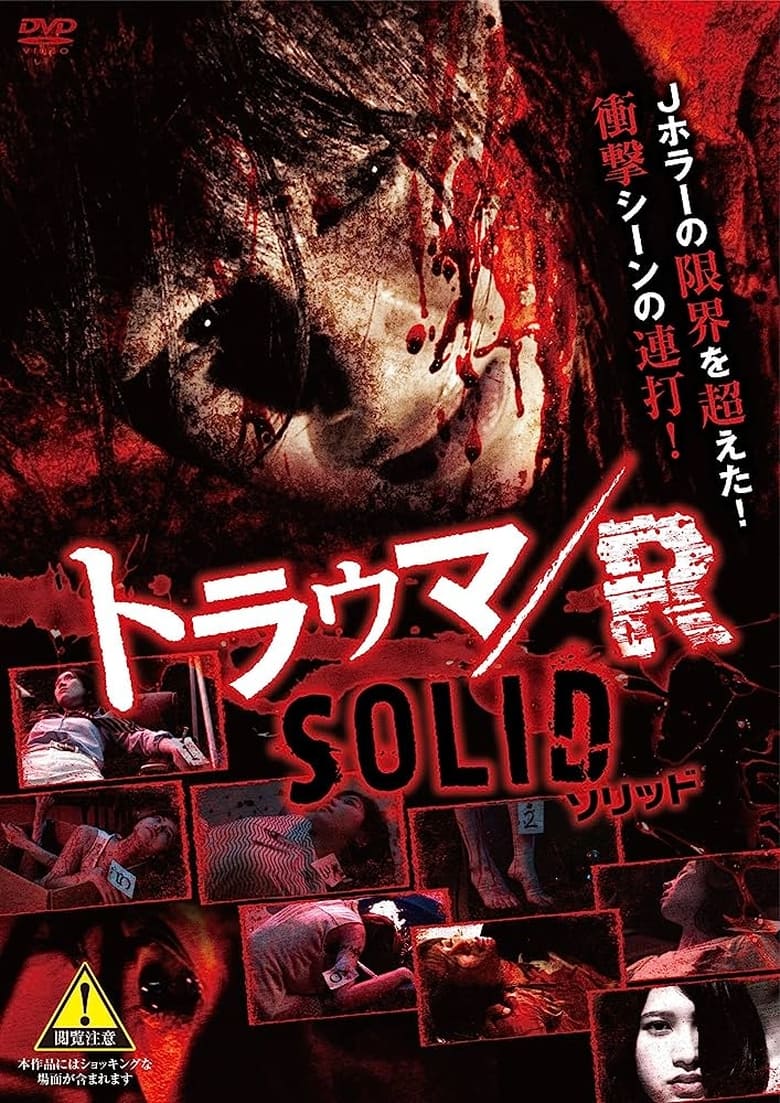 Poster of Trauma/R SOLID