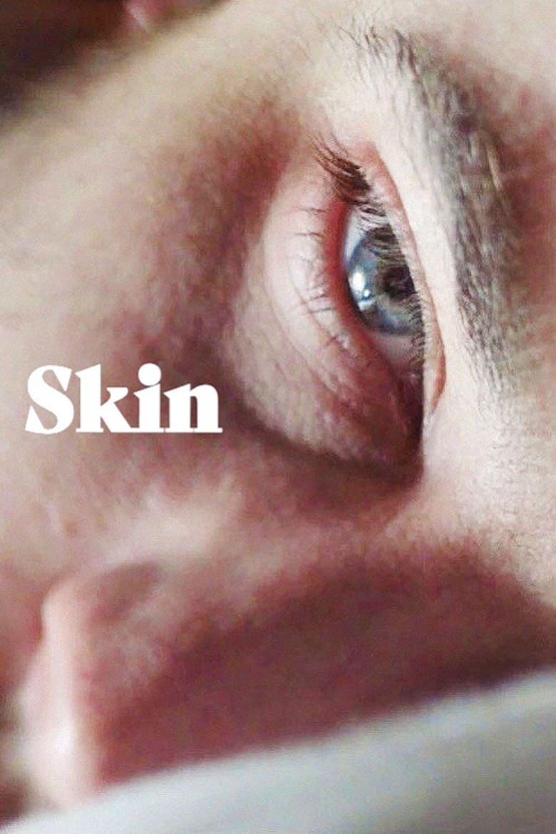 Poster of Skin