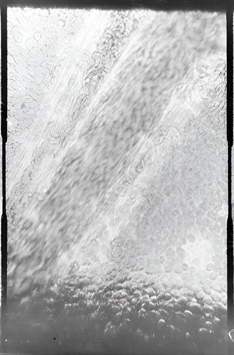 Poster of Déplacement des globules de sang dans un vaisseau capillaire