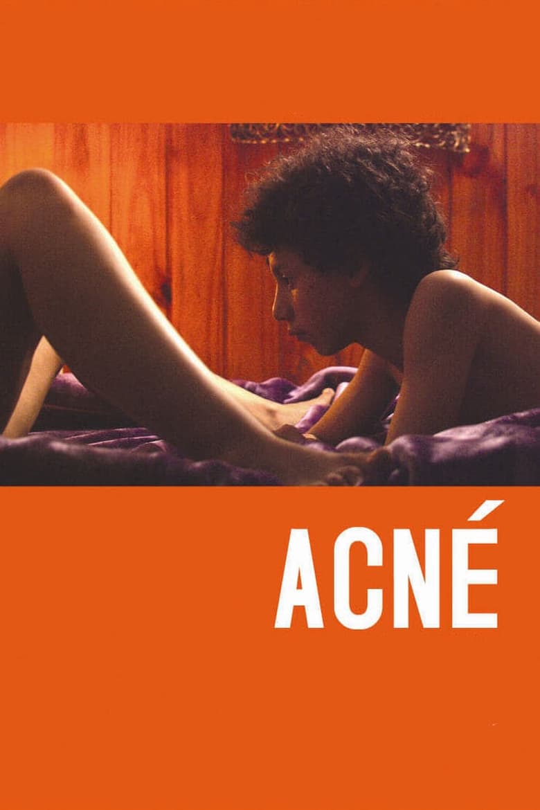 Poster of Acne