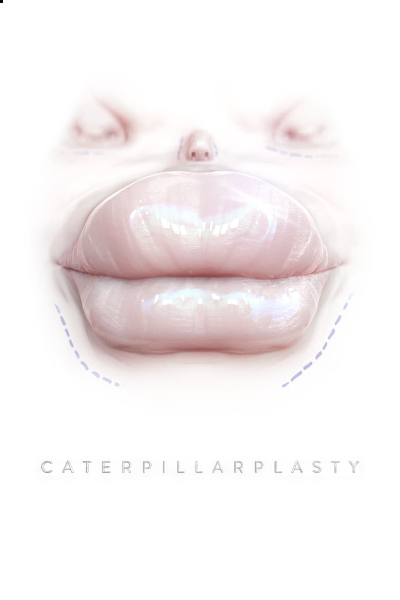 Poster of Caterpillarplasty